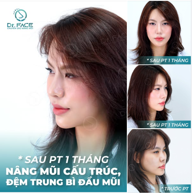 Mũi cao chẳng ngại gió đông,  Xinh xinh rạng rỡ má hồng thêm tươi.