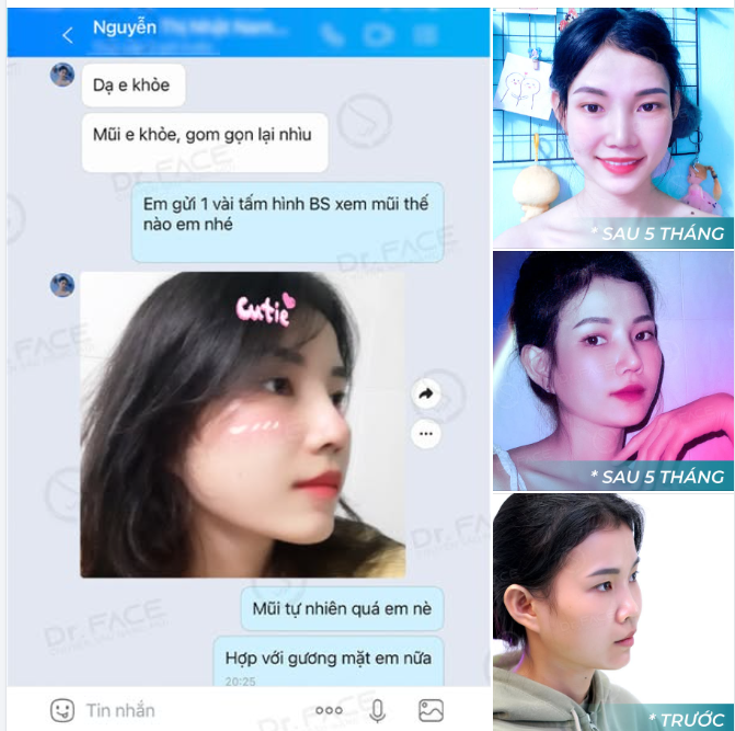 Đầu mũi TRÒN MỀM xinh xinh  Mỗi lần cười nhẹ “rung rinh” bao người