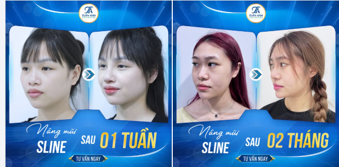 LỘT XÁC THÀNH CÔNG
