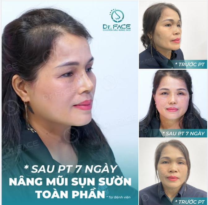 ĐEO KÍNH không còn là điều BẤT KHẢ THI