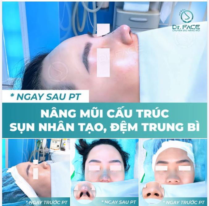 ​​​​​​​ DR.FACE cung cấp TẤT CẢ CÁC GIẢI PHÁP về NÂNG MŨI và LÀM ĐẸP KHUÔN MẶT