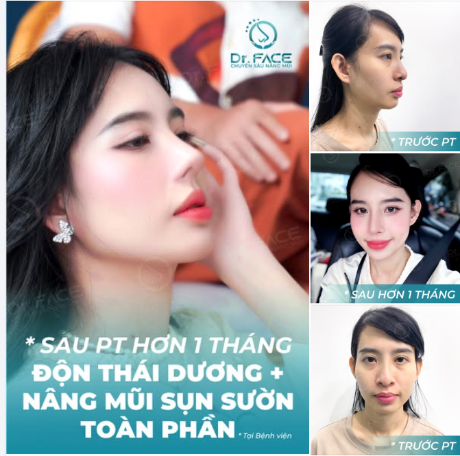 ẢNH TRƯỚC HAY ẢNH SAU “DỊU” HƠN