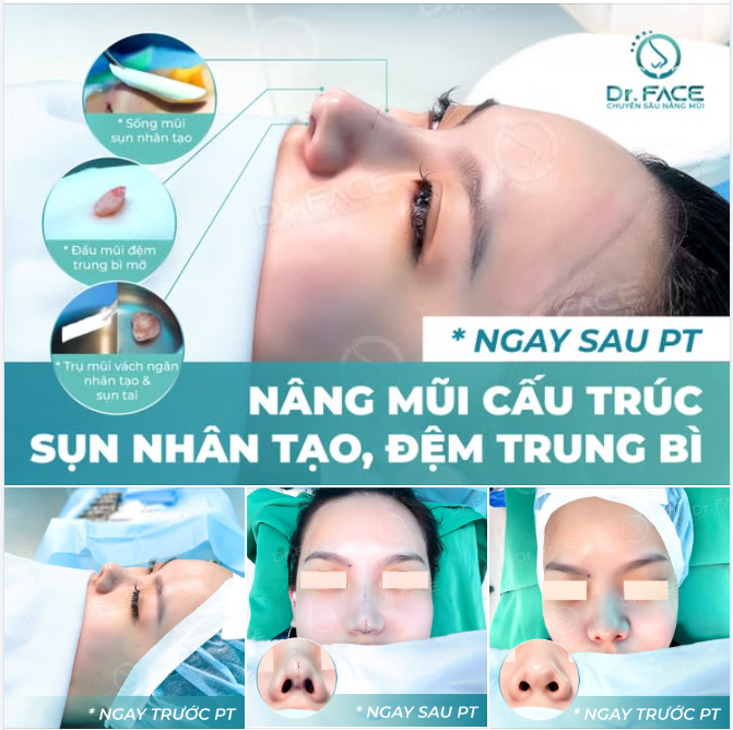 XINH RỒI CÒN LÀM MŨI GÌ NỮA