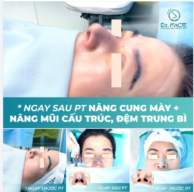 10 NĂM sau ngày THÁO SỤN, chị mới MỈM CƯỜI MÃN NGUYỆN