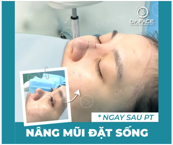 GÓC NGHIÊNG “LÊN HƯƠNG” CHỈ SAU 30 PHÚT