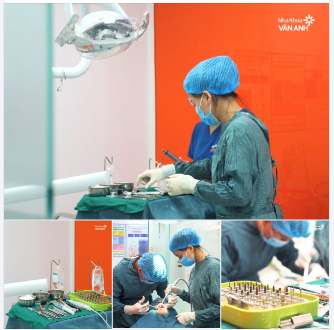 “Một ca Implant thành công không chỉ nhờ bàn tay bác sĩ…”
