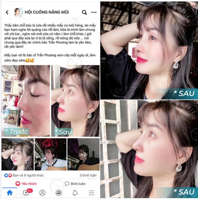 FEEDBACK NHO NHỎ, HẠNH PHÚC TO TO