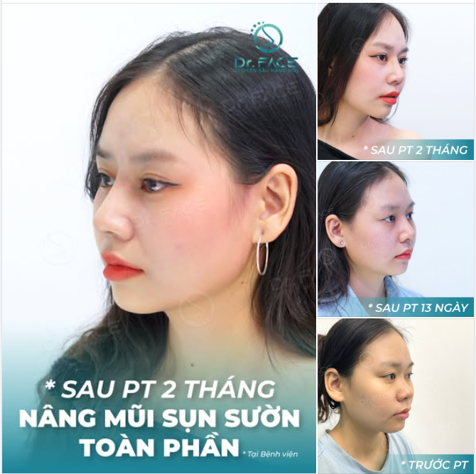 Yêu cái đẹp là thưởng thức  Tạo ra cái đẹp là nghệ thuật