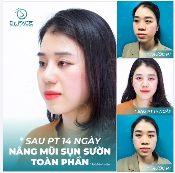 Cái gì cũng có mặt trái mặt phải  Chỉ có mặt này là mãi dễ thương…