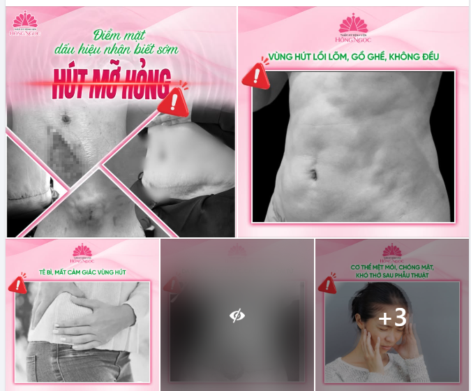 ĐIỂM MẶT NHỮNG DẤU HIỆU NHẬN BIẾT SỚM 1 CA HÚT MỠ HỎNG!