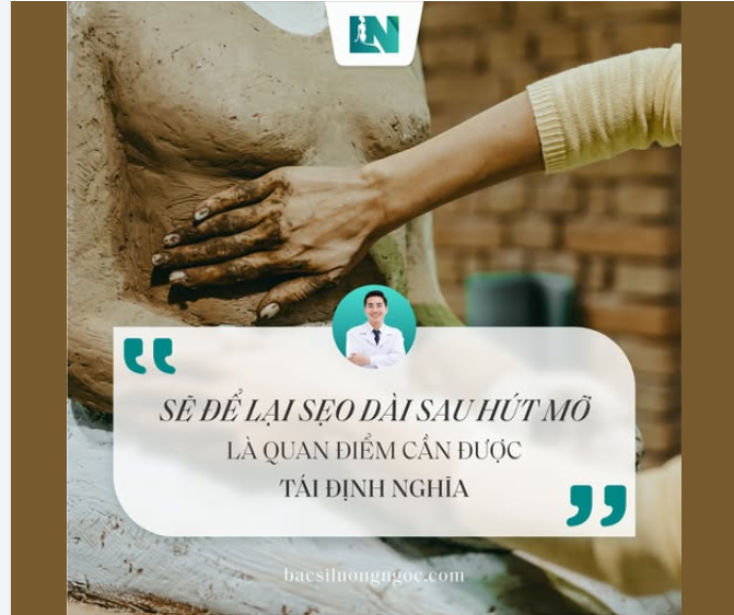 SẼ ĐỂ LẠI SẸO DÀI SAU HÚT MỠ, LÀ QUAN ĐIỂM CẦN ĐƯỢC TÁI ĐỊNH NGHĨA