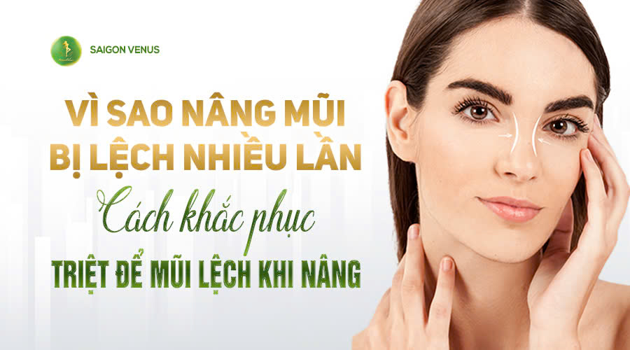 VÌ SAO NÂNG MŨI BỊ LỆCH NHIỀU LẦN? – GIẢI PHÁP KHẮC PHỤC TRIỆT ĐỂ TẠI SAIGON VENUS