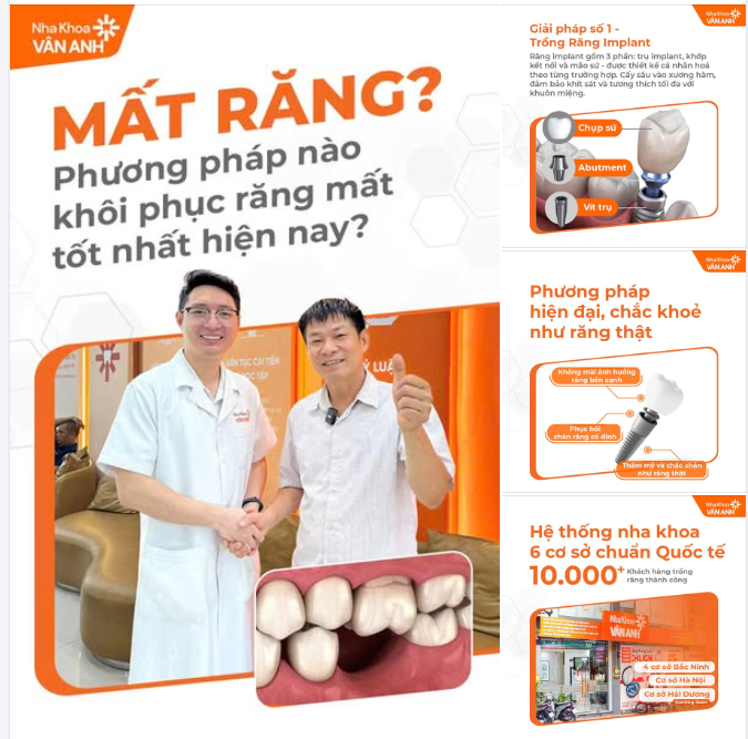 Mất răng – nên lựa chọn phương án nào để vừa ăn nhai tốt, vừa giữ được sức khỏe lâu dài?