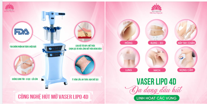 Mỡ thừa "chiếm chỗ" trên cơ thể? Đừng lo! Đã có Vaser Lipo 4D tại Thẩm mỹ Bệnh viện Hồng Ngọc giúp bạn tự tin lấy lại đường cong
