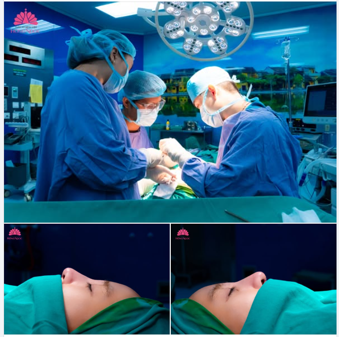 Tạm biệt mũi cũ, tạo dáng mũi mới - đẹp chuẩn chỉ trong 1 lần thực hiện