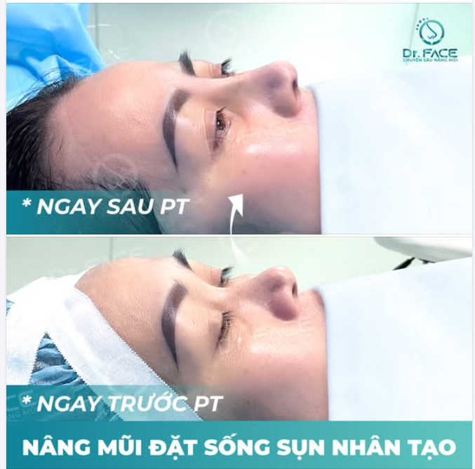 Chuẩn bị tài chính nâng GÓI “TO TO”, ai dè BS cho GÓI “NHỎ NHỎ”
