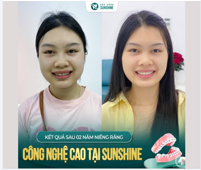 2 NĂM KIÊN TRÌ NHẬN LẠI NỤ CƯỜI XỨNG ĐÁNG