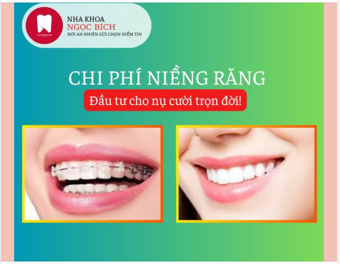 Chi phí chỉnh nha – Đầu tư cho nụ cười trọn đời!