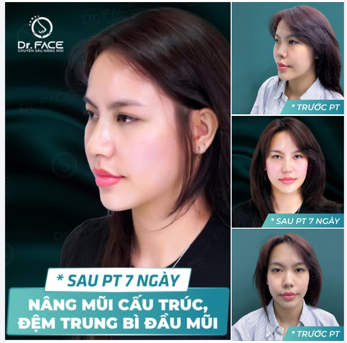 Đặt nét mũi, vẽ đường duyên,  Tự nhiên đến mức ai nhìn cũng thương.