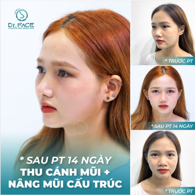 KHÔNG FILTER VẪN XINH NHƯ BÚP BÊ