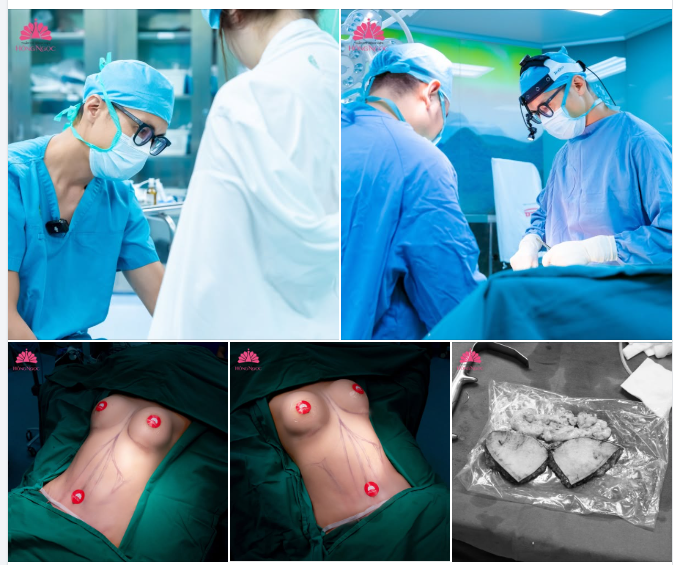 NGỰC ĐẸP EO XINH - TỰ TIN HẾT MÌNH CHỈ TRONG 1 LẦN THỰC HIỆN