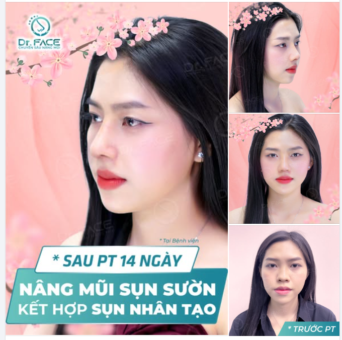 Chị làm trước, em theo sau,  Giờ ai cũng phải “ồ wow” khen liền.