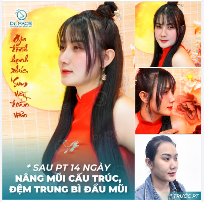 Trung thu trăng sáng treo ngang ngõ,  Mũi thon nghiêng nhẹ, nét thu vào...
