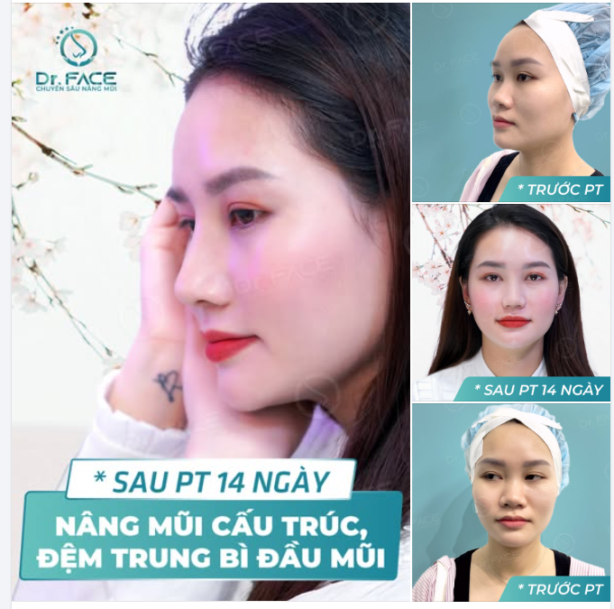 Sống mũi cao, thần thái ngời ngời,  Bừng lên nhan sắc, rạng ngời niềm vui.