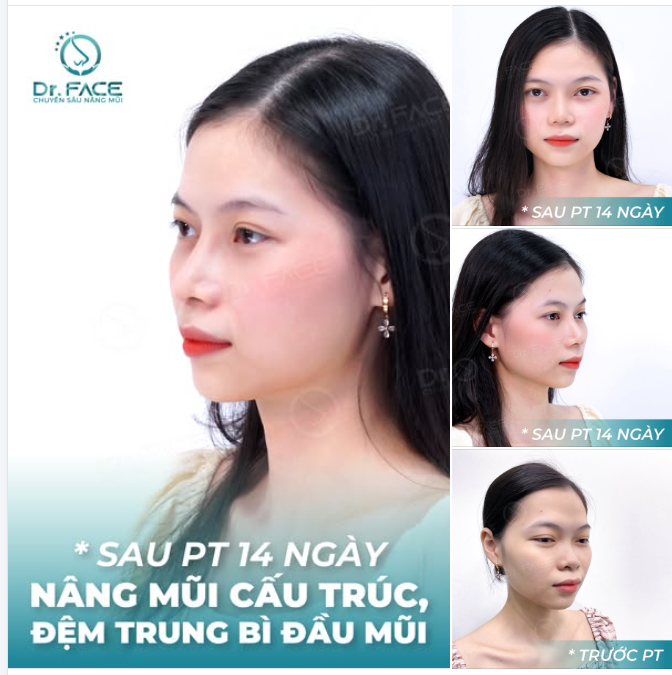 Có những tia nắng làm sáng cả bầu trời  Có những chiếc mũi làm rạng ngời cả thanh xuân.