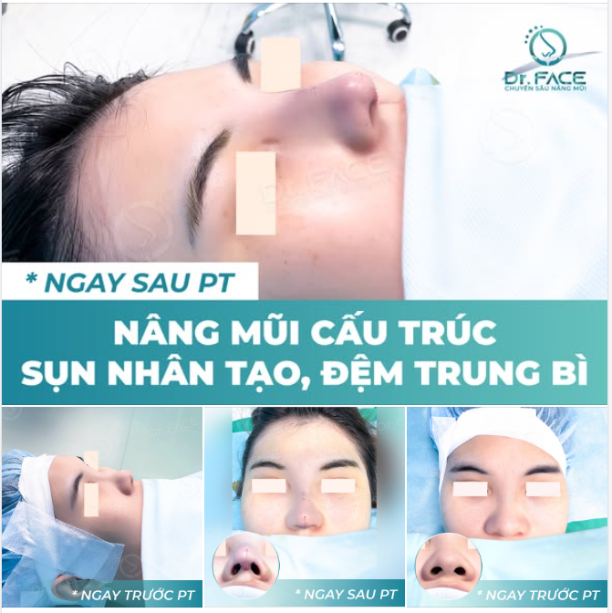 CHIẾC MŨI NÀY CÓ NHỮNG VẤN ĐỀ GÌ