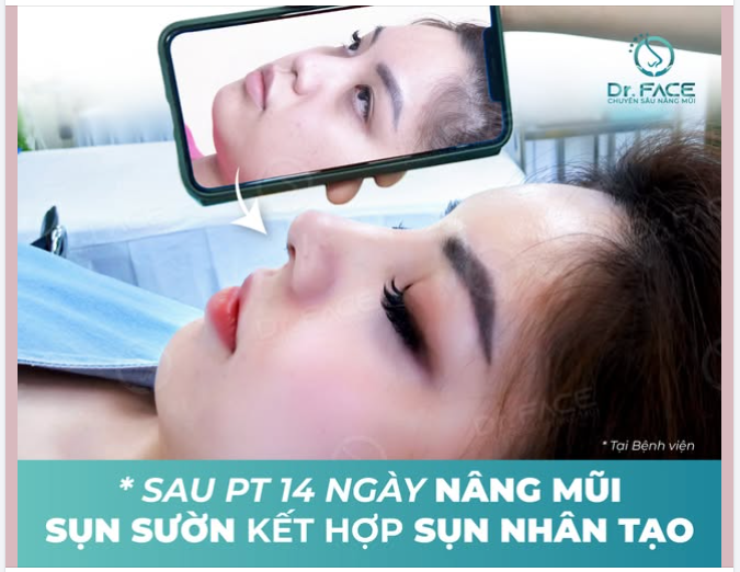 Một chút chỉnh nhẹ, VISUAL lên hẳn nét ‘TÂY TÂY’ XỊN XÒ!