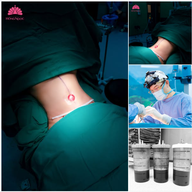 VÓC DÁNG HOÀN HẢO - KIẾN TẠO BODY CHUẨN ĐẸP TỪNG MILIMET