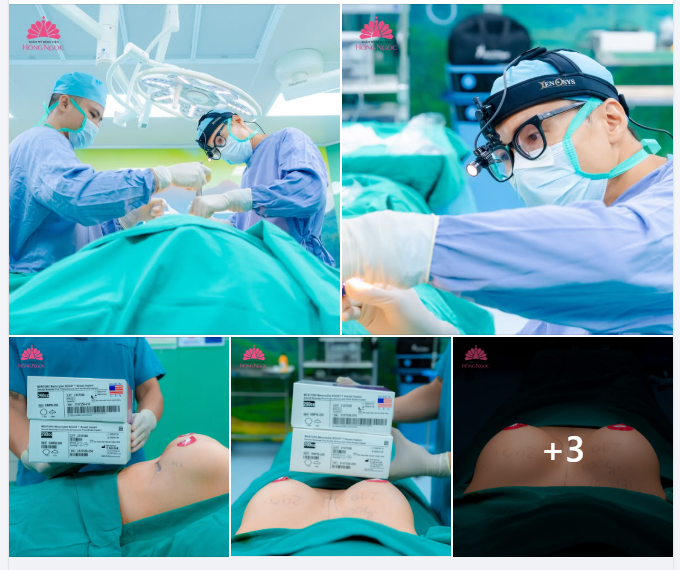 CHIÊM NGƯỠNG V1 "SIÊU PHẨM" NGAY SAU KHI NÂNG CẤP CÙNG MENTOR MEMORYGEL BOOST