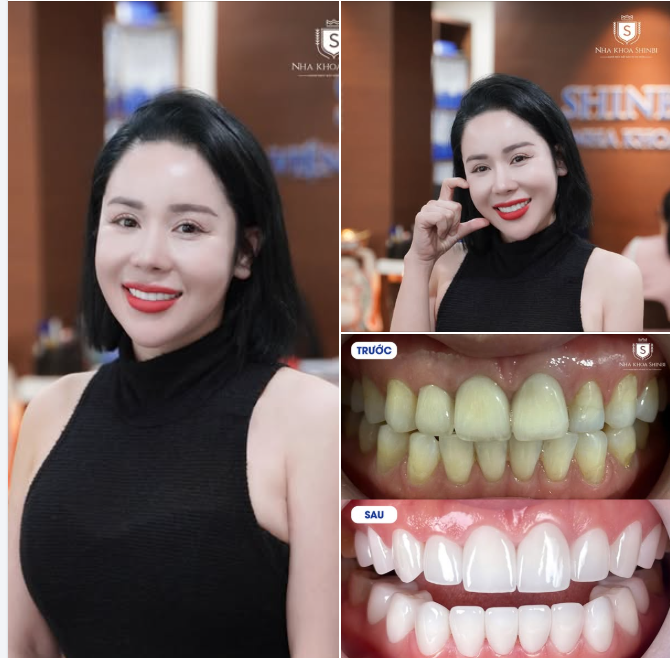 Khi điều trị và thẩm mỹ cùng hội tụ trong một nụ cười hoàn hảo