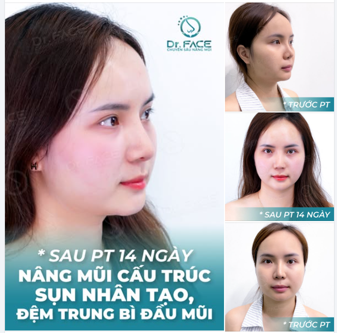 Nắng vàng rực rỡ lung linh phố,  Dáng mũi thanh tao rạng nụ cười.