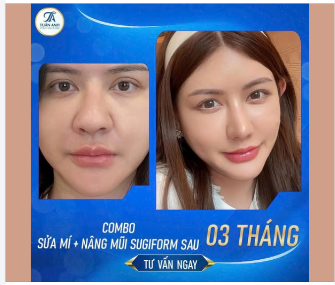 XÓA APP CHỈNH ẢNH: Đẹp thật tựa nàng thơ chỉ trong 3 tháng!
