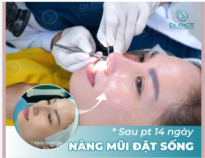 ĐẶT SỐNG LẦN 2 – LẦN NÀY MŨI ‘CÓ GU’ HƠN HẲN