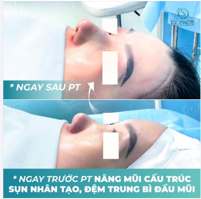 MỘT GÓC NGHIÊNG MỚI, MỘT NIỀM TIN MỚI
