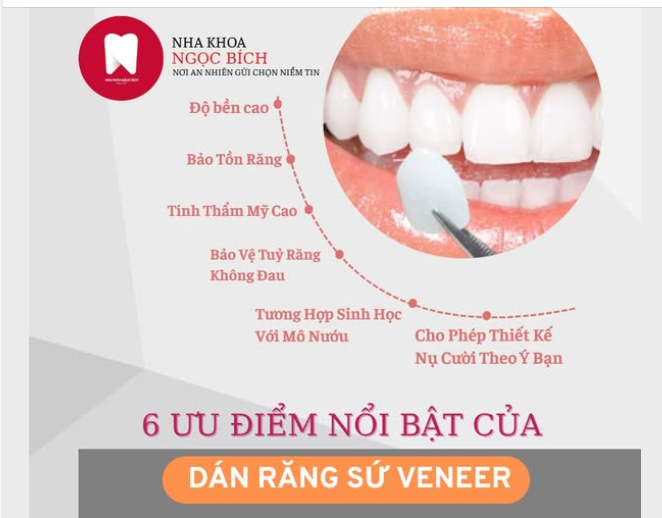 6 ƯU ĐIỂM NỔI BẬT CỦA DÁN RĂNG SỨ VENEER
