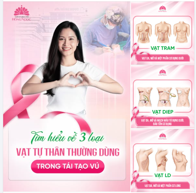 HIỂU ĐÚNG VỀ 3 LOẠI VẠT TỰ THÂN THƯỜNG DÙNG TRONG TÁI TẠO VÚ: TRAM, DIEP VÀ LD