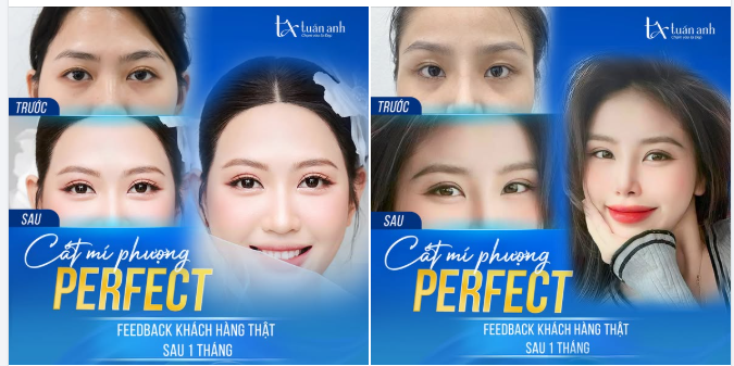 MẮT ĐẸP VẠN NGƯỜI MÊ KHÔNG CÒN LÀ MƠ ƯỚC
