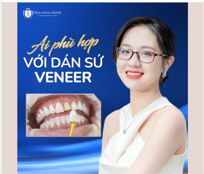 AI PHÙ HỢP VỚI DÁN SỨ VENEER?