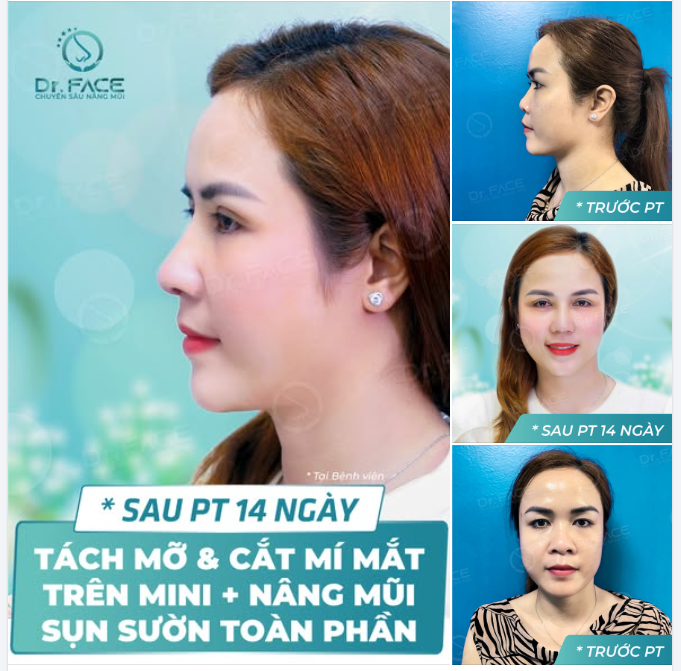 “COMBO NÀY LÀM XONG CHỈ MUỐN SOI GƯƠNG CẢ NGÀY”