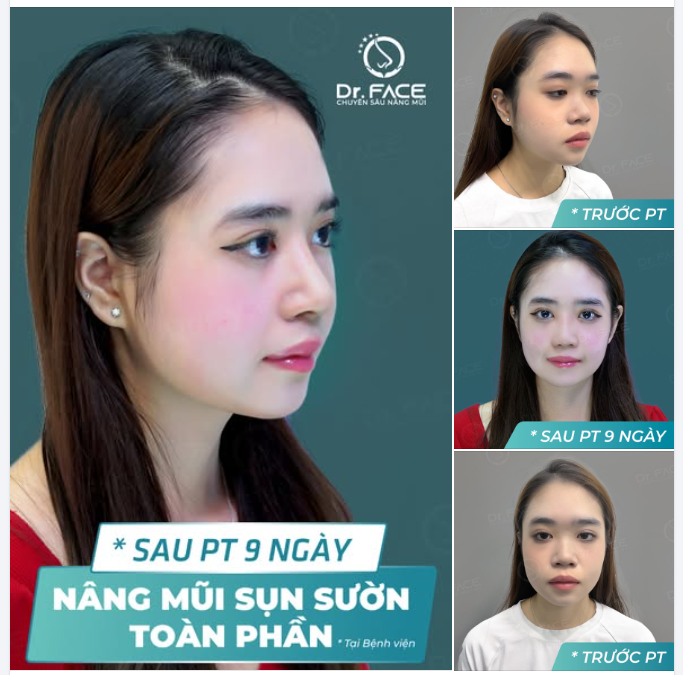 Mũi cao tôn dáng kiêu sa,  Tỏa hương nhan sắc, ngỡ là tiên sa.