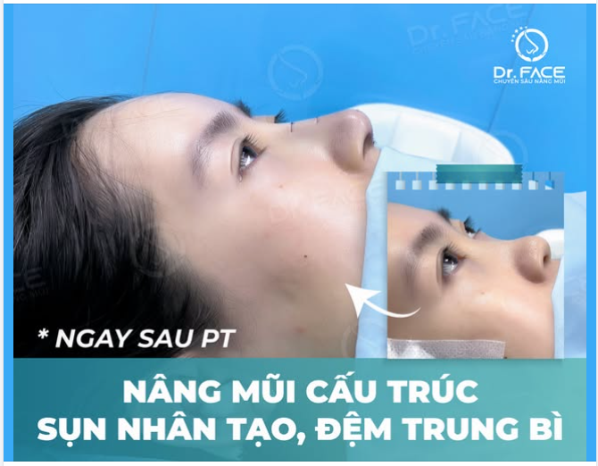 LIM DIM THEO NHẠC, NÂNG MŨI NHẸ NHƯ MỘT “GIẤC MƠ TRƯA”