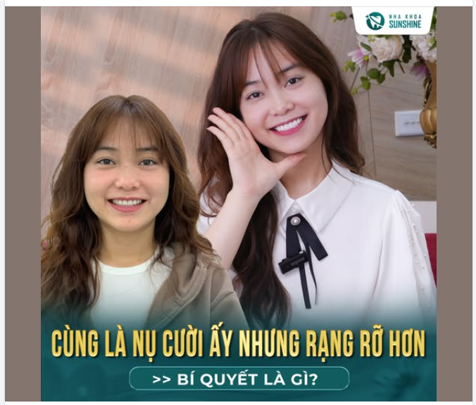 CÙNG LÀ NỤ CƯỜI ẤY, NHƯNG SAO NAY LẠI RẠNG RỠ HƠN?