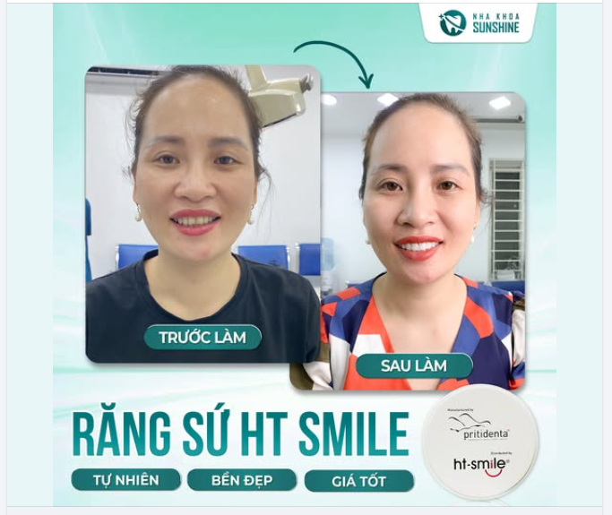 Chỉ một sự thay đổi nhỏ trên gương mặt... nhưng có thể giúp bạn tự tin hơn gấp 10 lần!