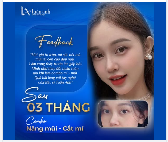 MỞ RA CÁNH CỬA TỰ TIN VỚI ĐÔI MẮT THẦN THÁI