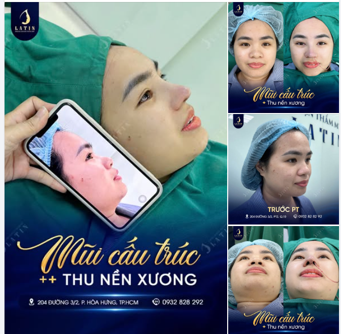 ĐỪNG CHỈ QUAN TÂM ĐẾN DÁNG MŨI MÀ KHÔNG CHỈNH SỬA NỀN