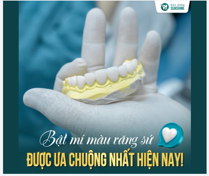 BẬT MÍ MÀU RĂNG SỨ “HOT” NHẤT HIỆN NAY TẠI SUNSHINE